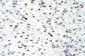 CUGBP2 antibody - N-terminal region